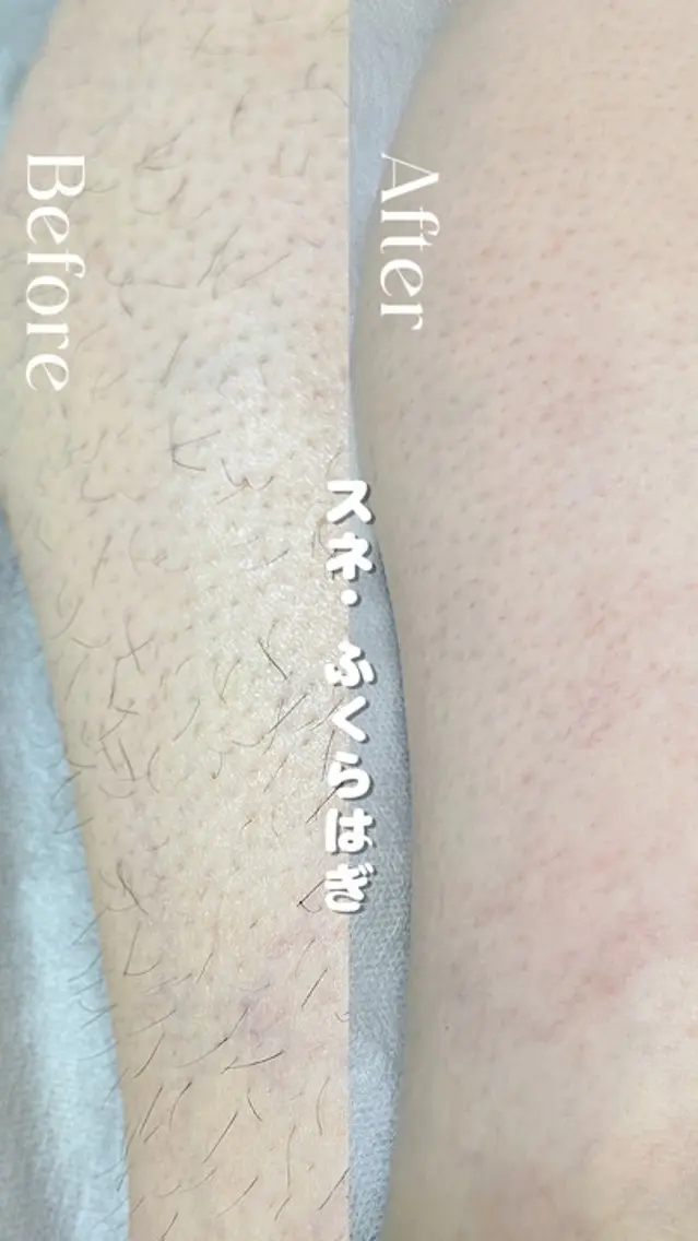 豊橋 ｜Hitomi シュガーリング専門店のエステ・リラクイメージ