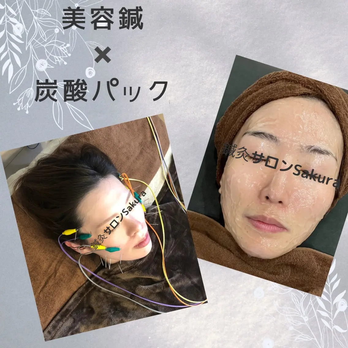 鍼灸サロン Sakuraのエステ・リラクイメージ
