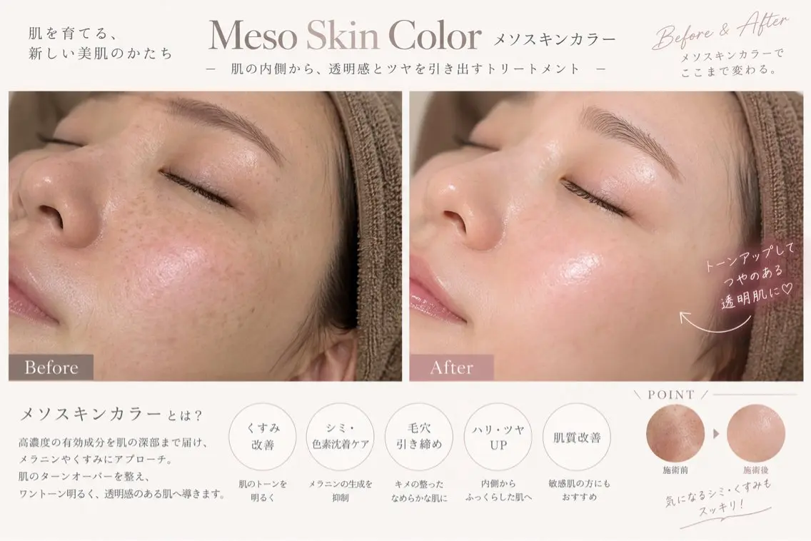エステ リラク 毛穴・肌質改善サロン réposのその他イメージ