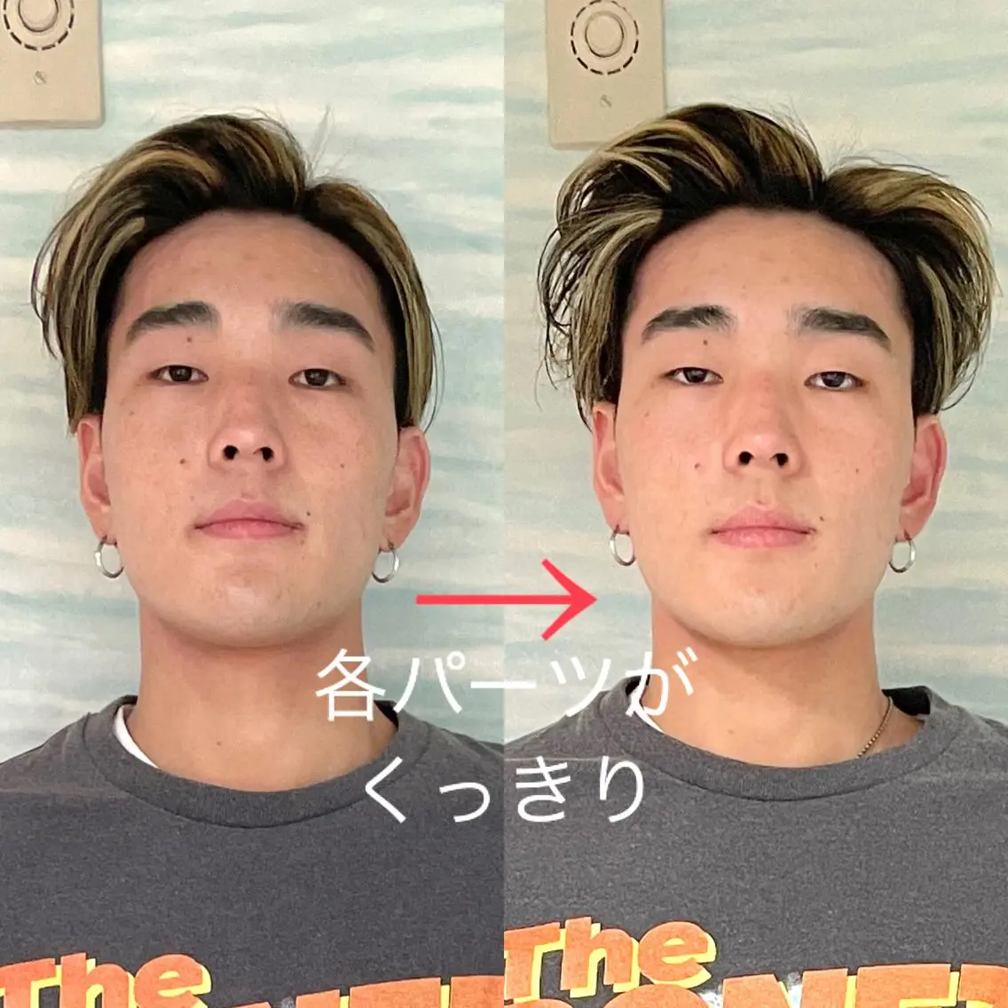メンズ歓迎⭐️【イケメン小顔矯正💆🏻‍♂️】掘り起こして垢抜ける　美肌　マスク無しで素顔に自信✨の写真