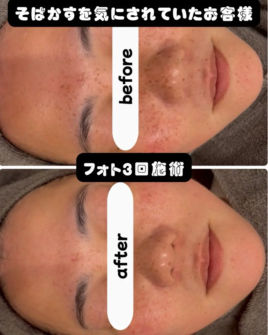 エステ シミケア専門サロン LICCO’S岡崎のエステ・リラクイメージ
