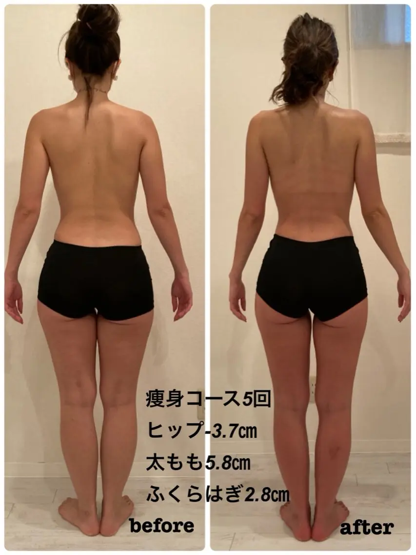 痩身効果絶大◎ダイエット回数券! 5回分のお得チケットです。の写真