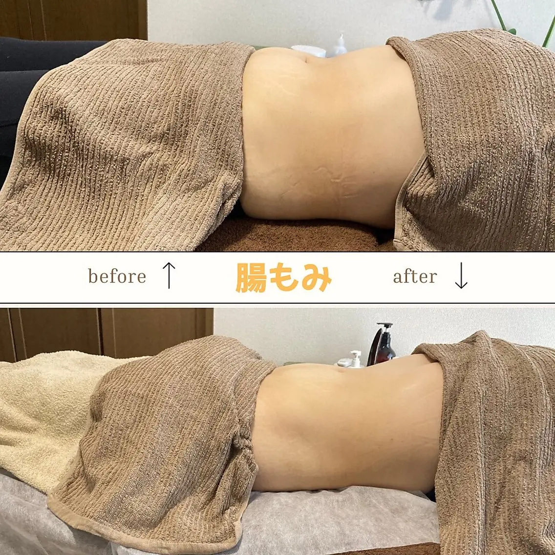 腸もみの写真