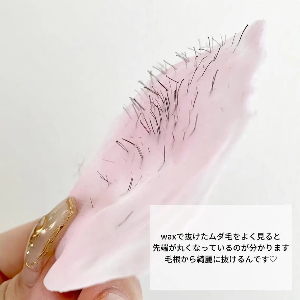 メンズ 脱毛 稲嶺 美華のエステ・リラクイメージ