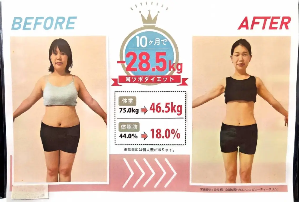 【ダイエットを始めたい方へ🌿】耳つぼ+カウンセリング体験の写真