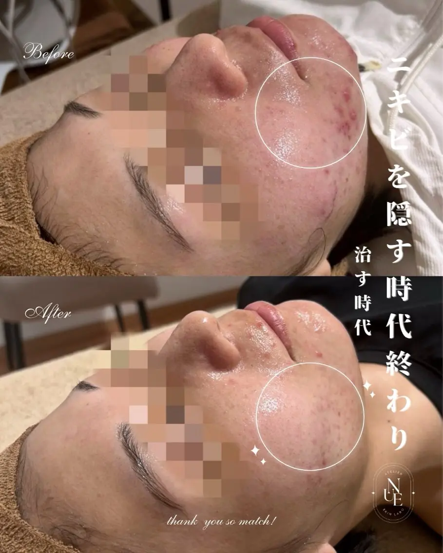 💎美容革命ラボ💎 大名店のエステ・リラクイメージ