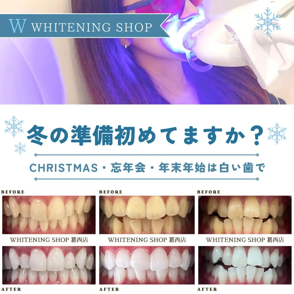 メンズ クリスマス その他 ホワイトニング ショップ葛西店のその他イメージ