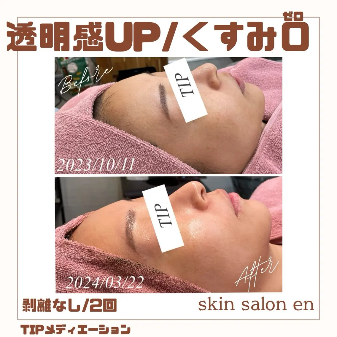 エステ skin salon enのエステ・リラクイメージ