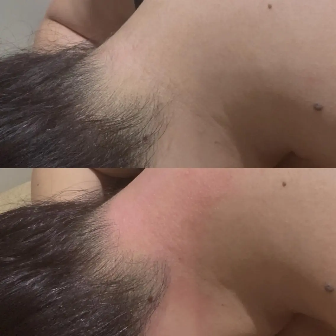 【女性】 すぐ予約限定! うなじワック&うなじ光脱毛の写真