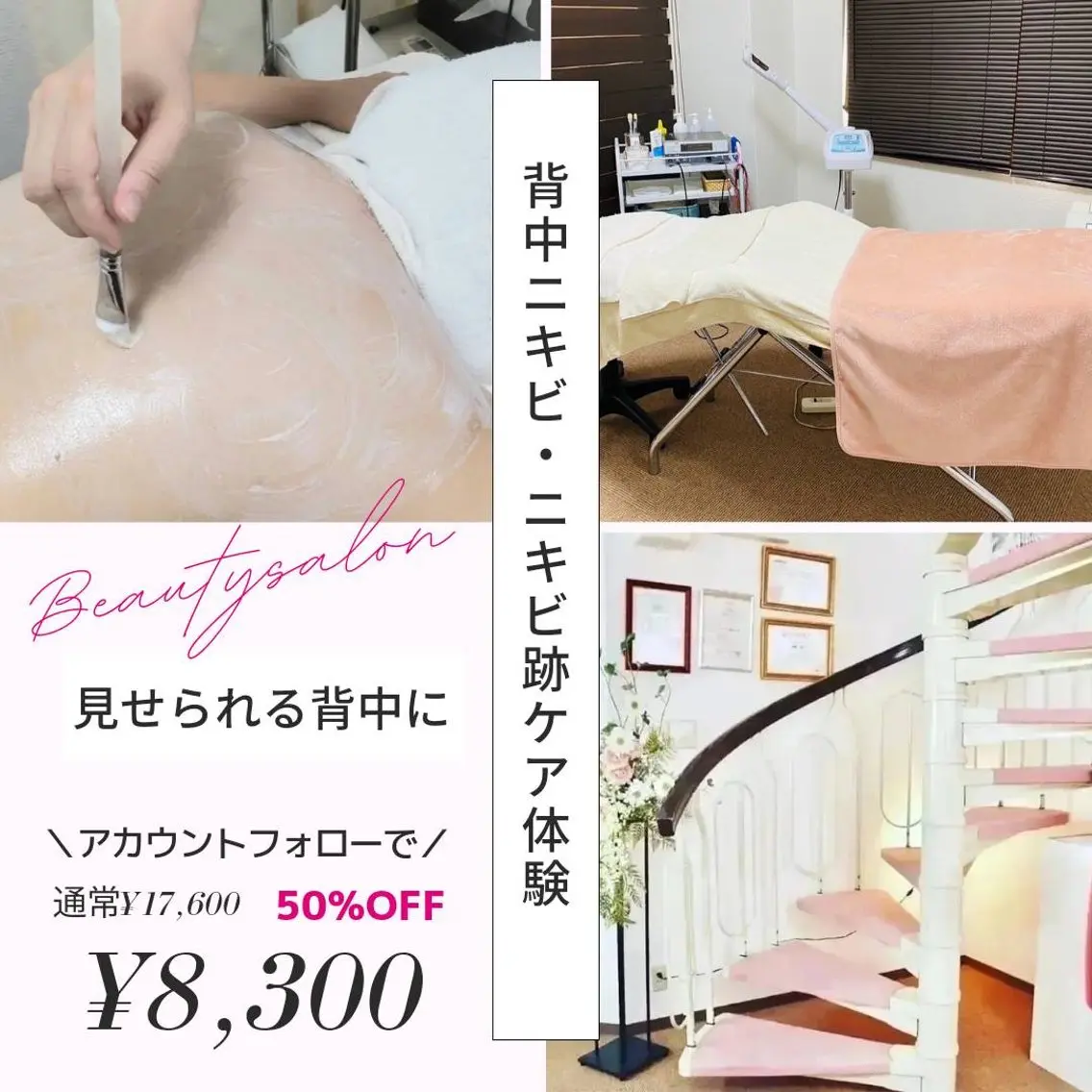 ニキビケア◇ニキビ跡 レゾン京橋店 八崎のエステ・リラクイメージ