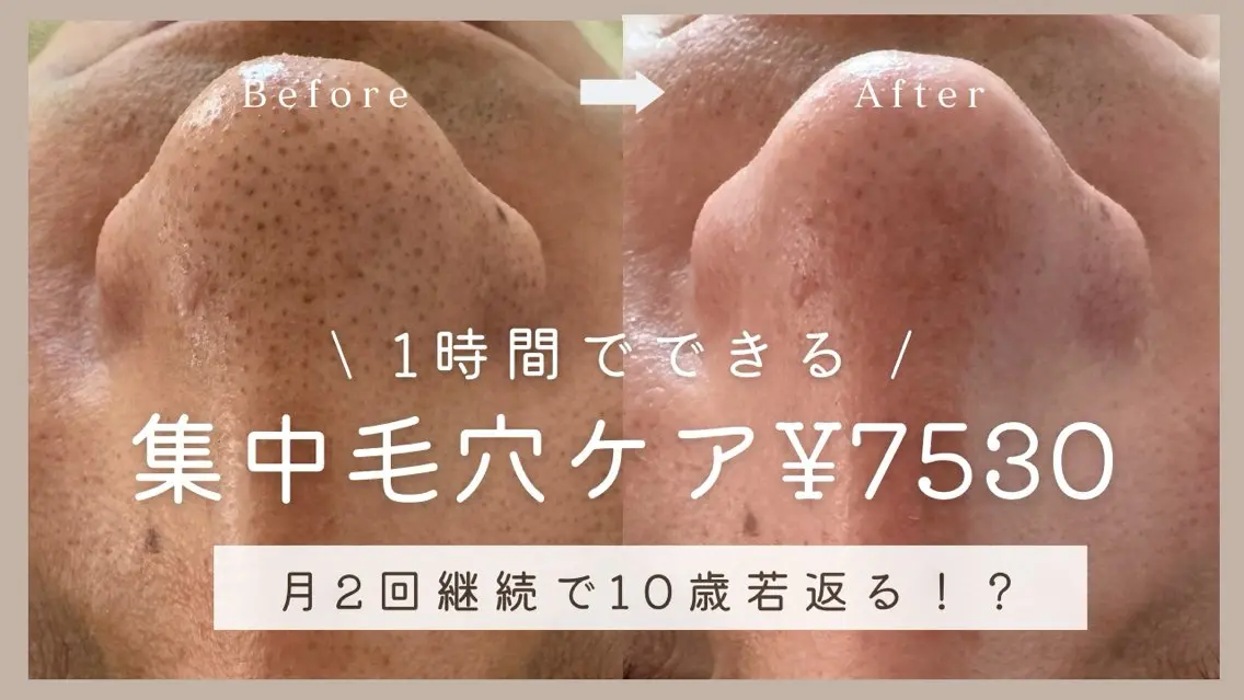 エステ リラク 寝る前に通える肌改善 専門サロンyuccaのエステ・リラクイメージ