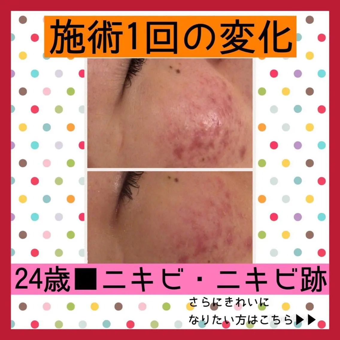 ミディアム カラー パーマ ヘアアレンジ メンズ キッズ ネイル マツエク・マツパ ニキビ・肌質改善専門 ♡人生が変わるサロンのエステ・リラクイメージ