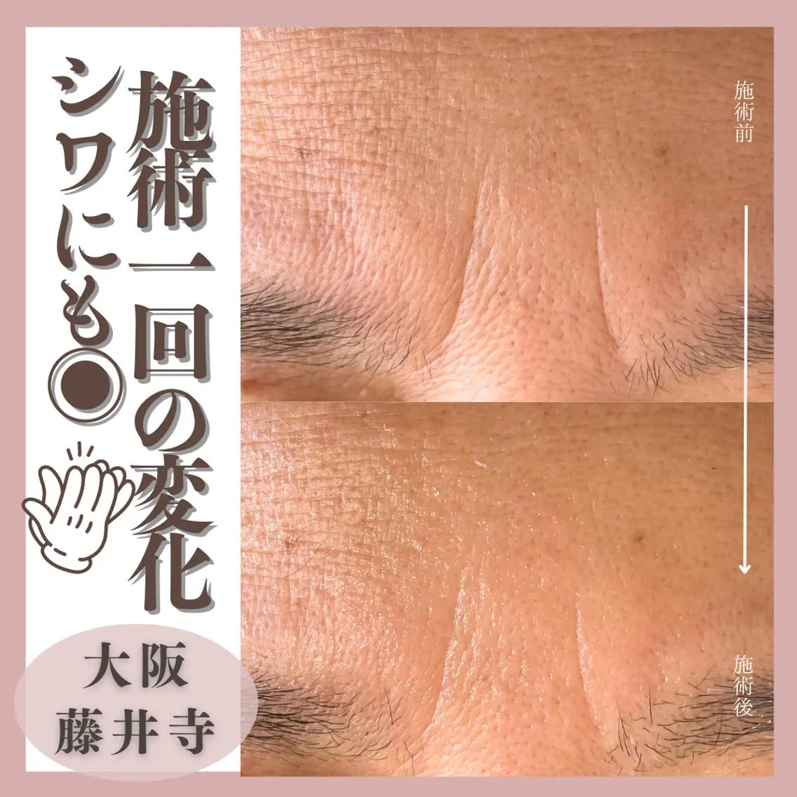 脱毛 Muqu. 毛穴サロンのエステ・リラクイメージ