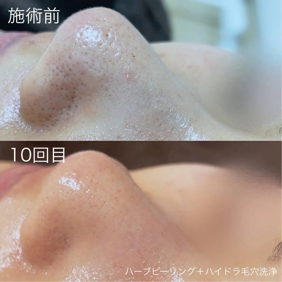 脱毛 lulula ricoのエステ・リラクイメージ