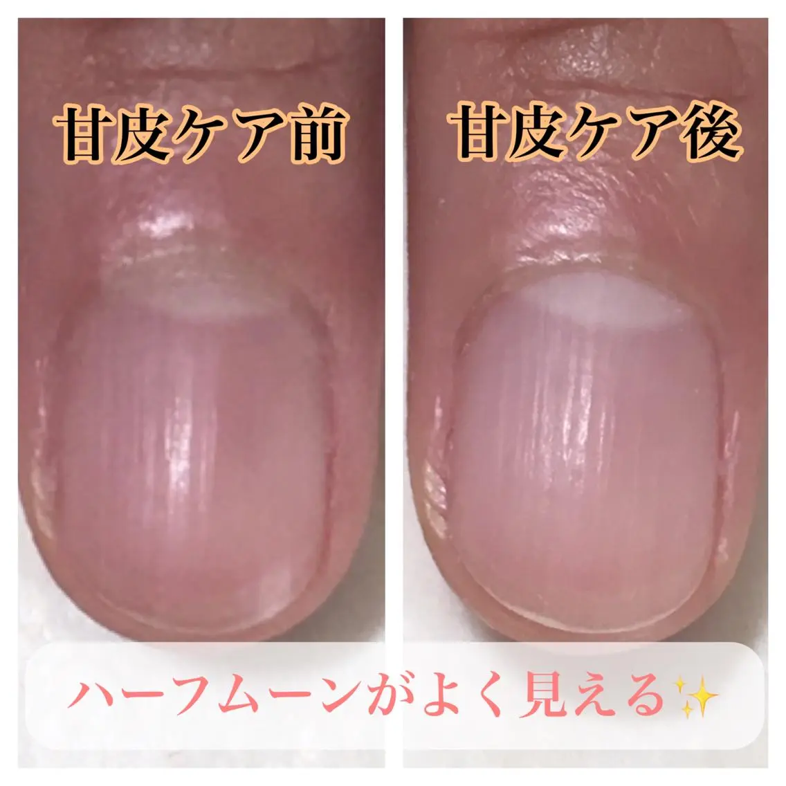 ネイル nailsalon Radditのネイルデザイン