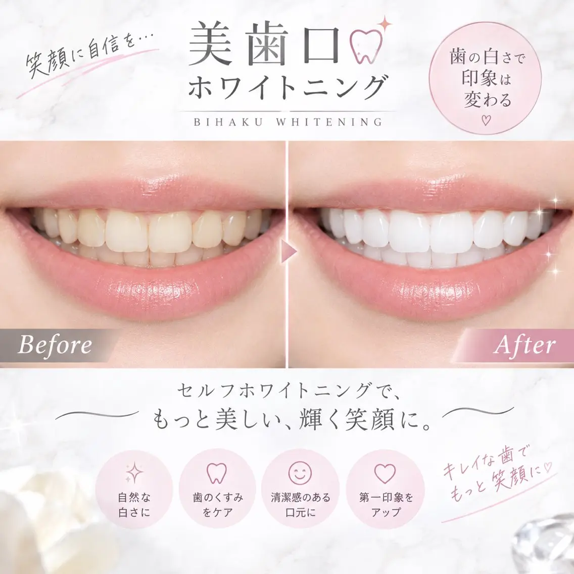オーラルケア セルフホワイトニング(スタンダード)の写真