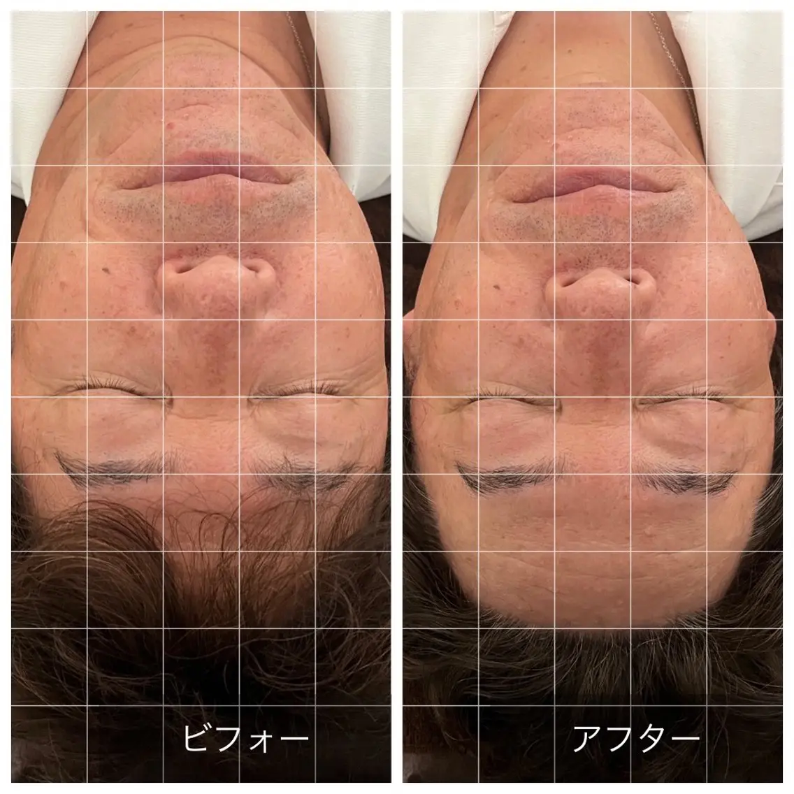 Relaxsalon undoのエステ・リラクイメージ