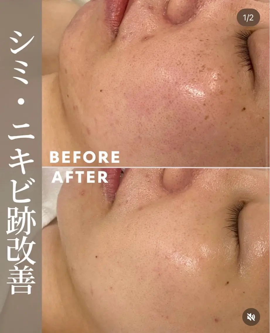 肌育成サロン みなみのエステ・リラクイメージ