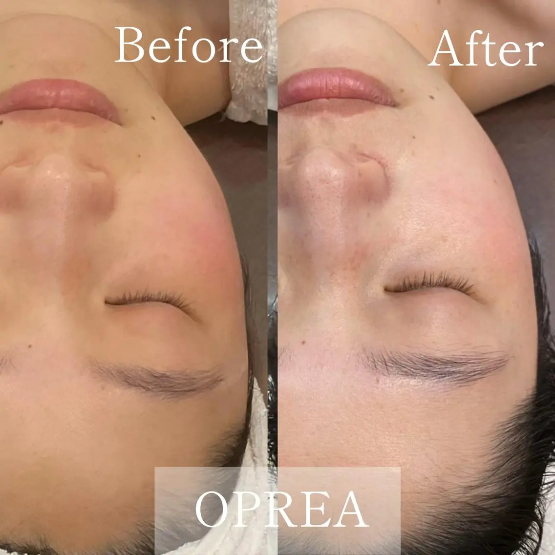 その他 OPREA 千種店のエステ・リラクイメージ