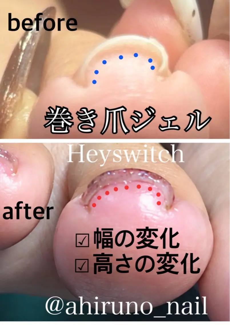 ネイル ジェルネイル フットネイル 東京あきる野市ネイル ✿ yuiのネイルデザイン