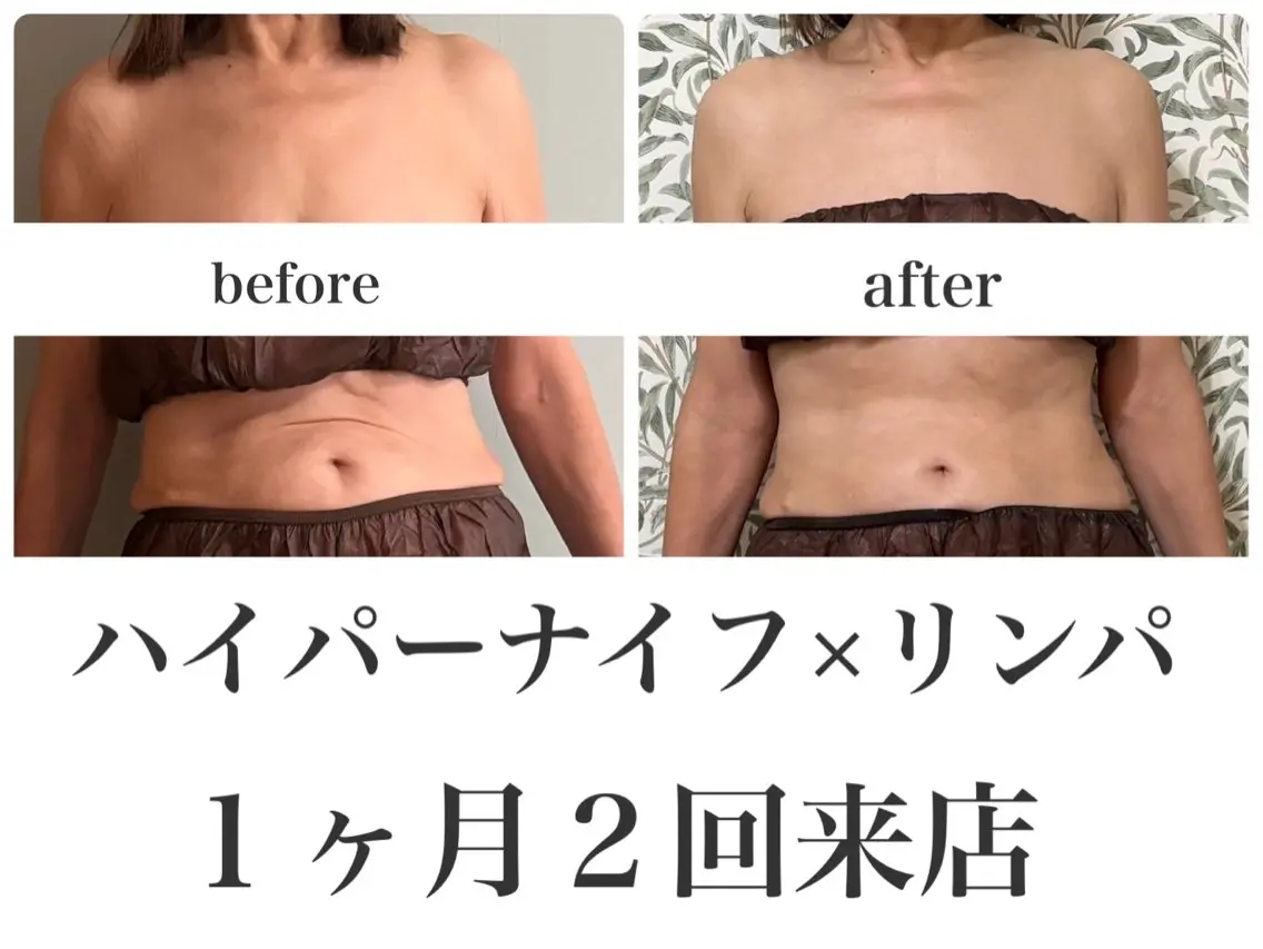 エステ 小林 雪乃のエステ・リラクイメージ