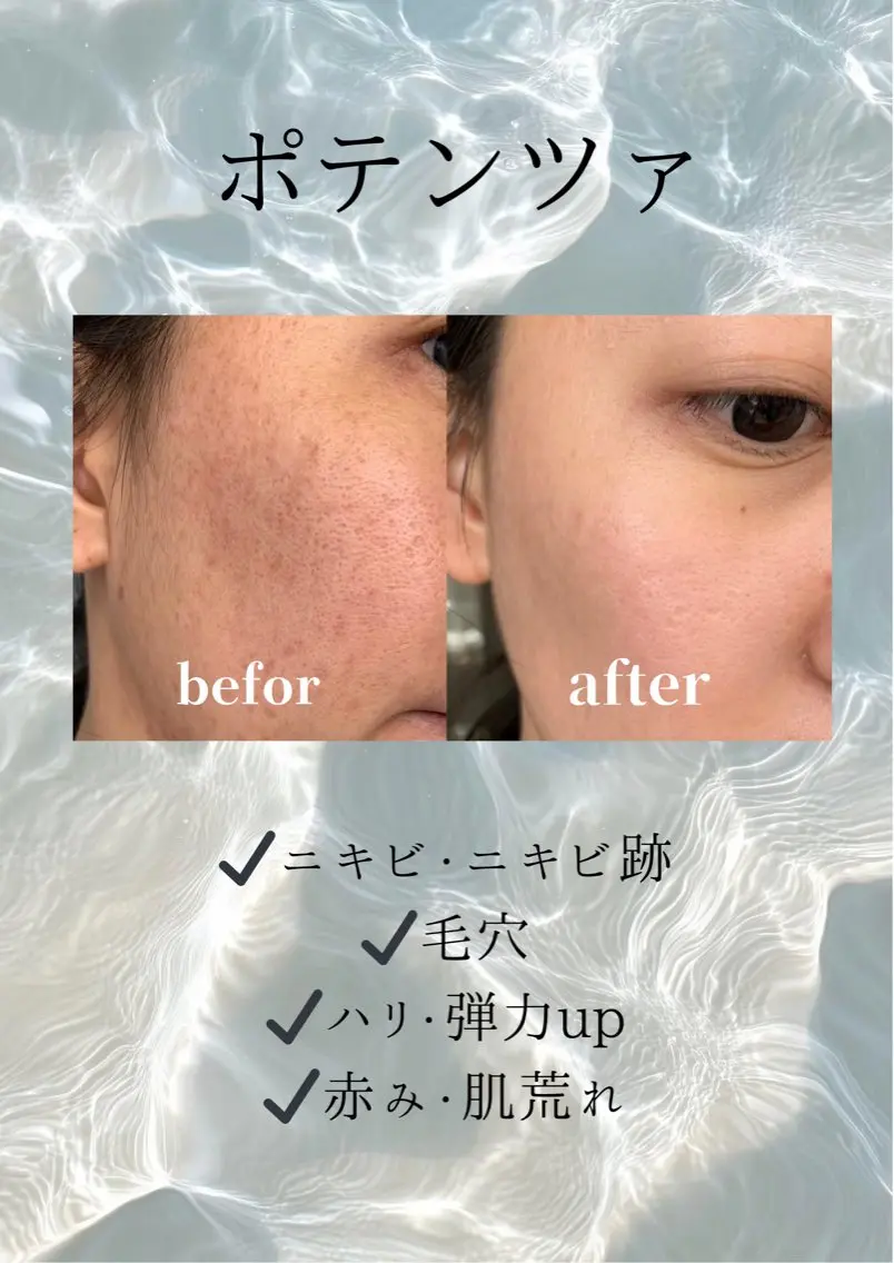 マツエク・マツパ エステ 愛維美水光美肌専門店 メンズレディースokのエステ・リラクイメージ