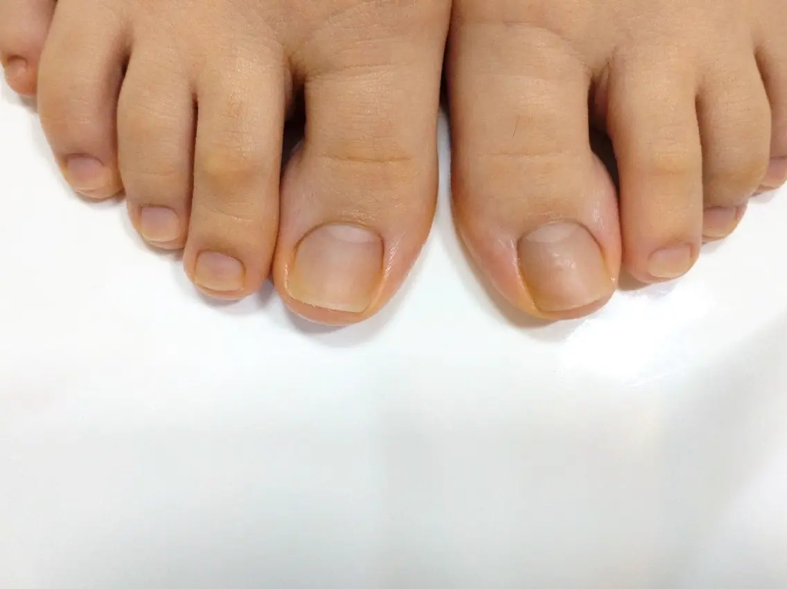 ネイル フットネイル nail 　norafu.のネイルデザイン