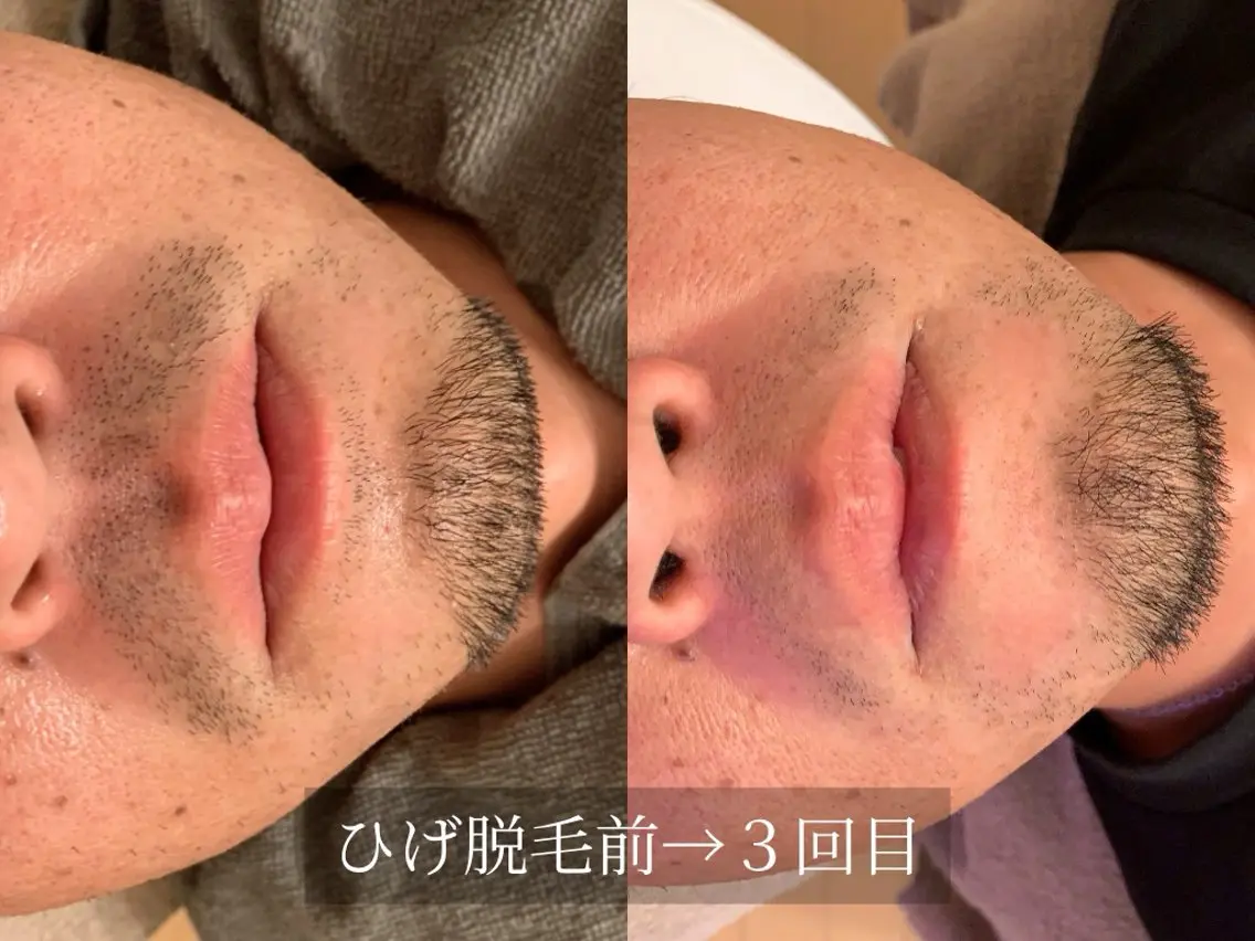 脱毛サロン Arumのエステ・リラクイメージ