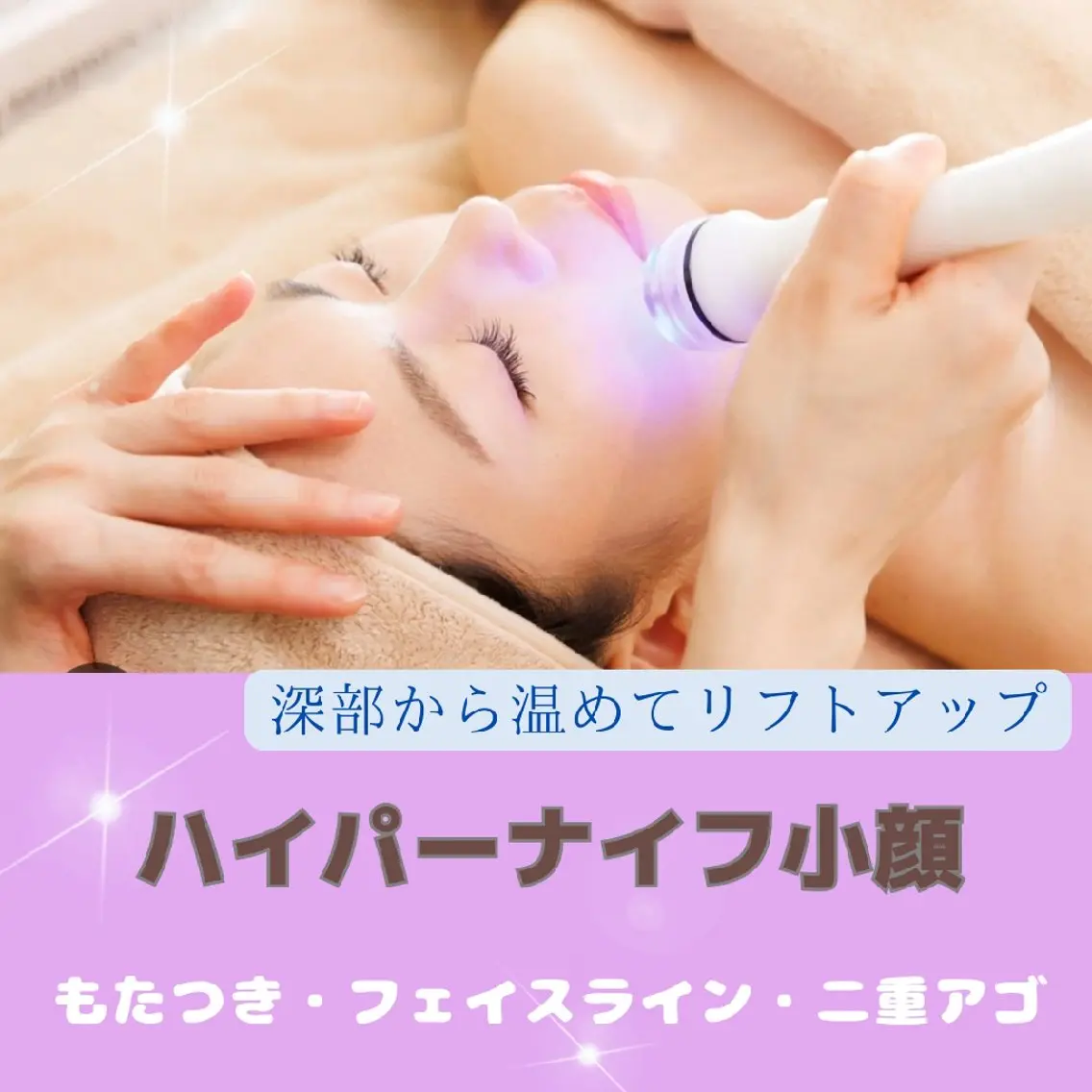 【顔のたるみ・もたつき】小顔ハイパーフェイシャル!スッキリシャープなリフトアップ!の写真