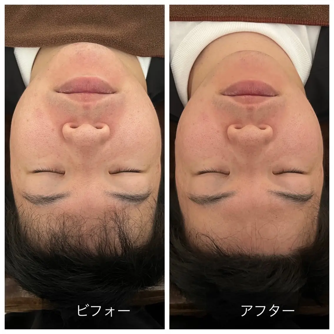 Relaxsalon undoのエステ・リラクイメージ