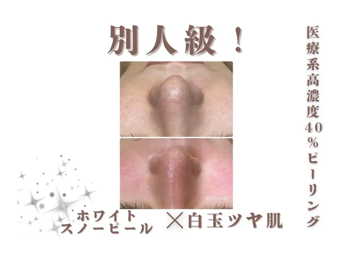 レイビス盛岡店 ♡吉田♡のエステ・リラクイメージ