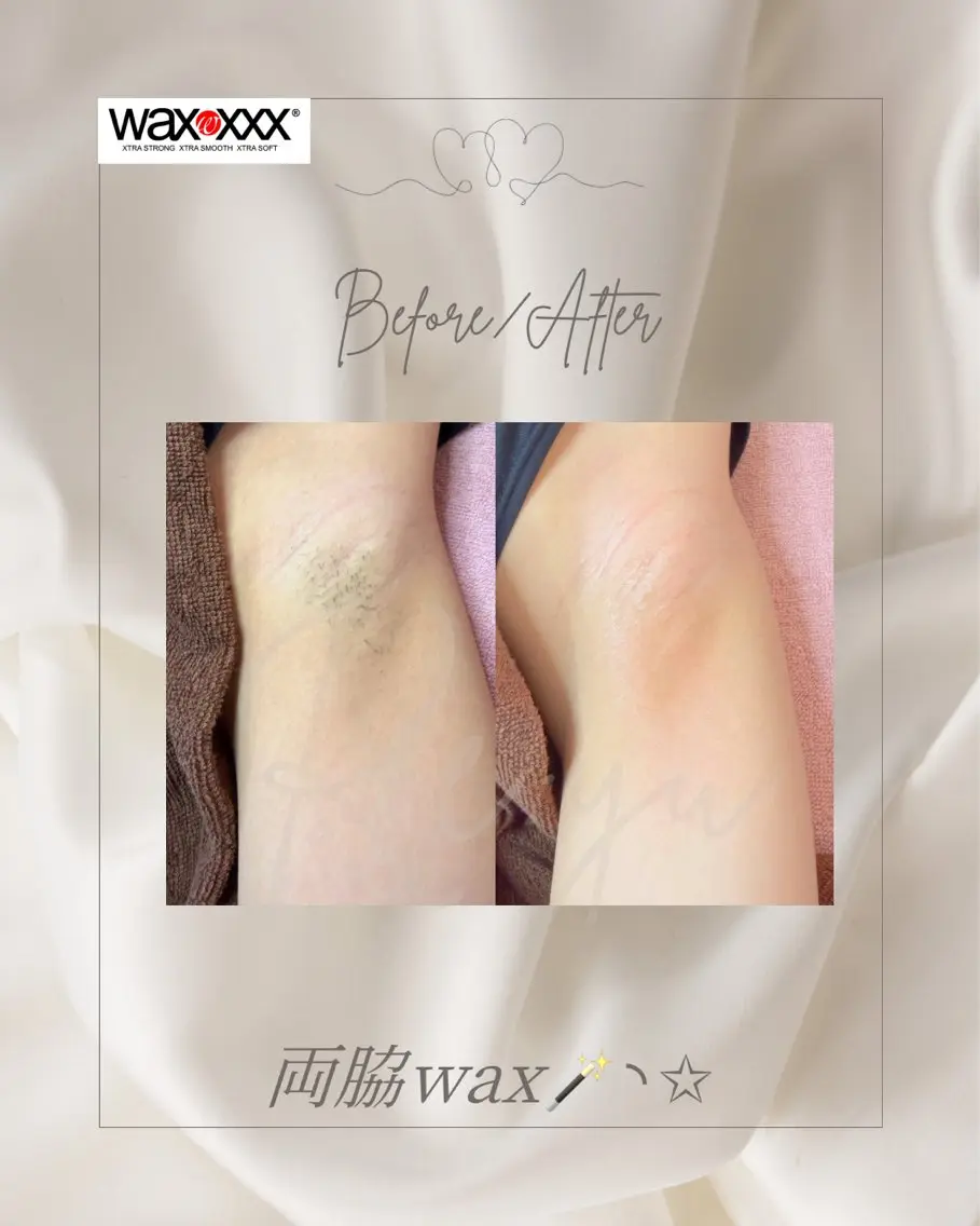 脱毛 Re:yu┃wax 脱毛┃糸島市のエステ・リラクイメージ