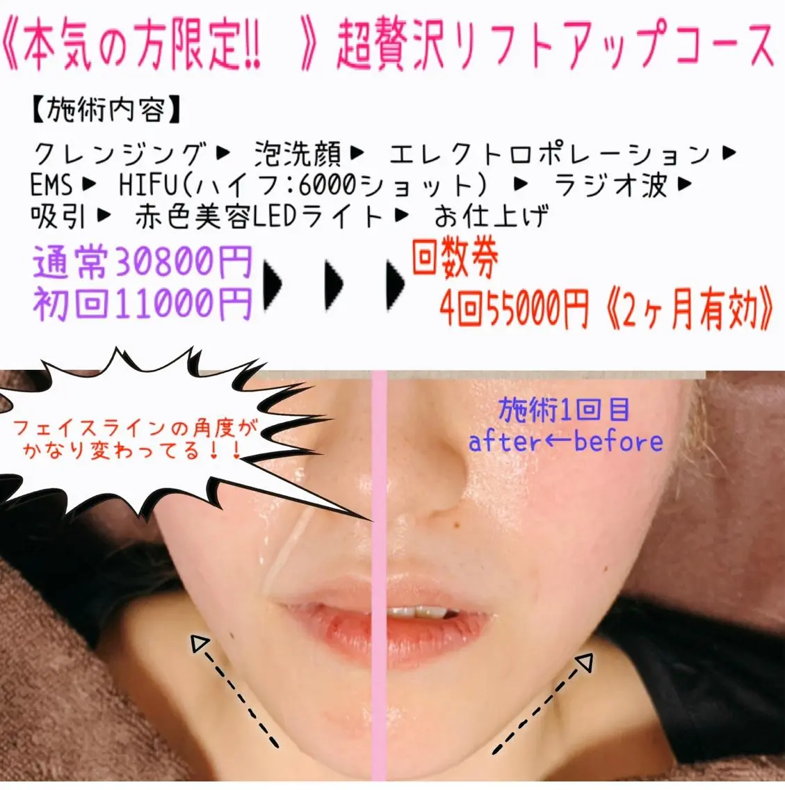 エステ HANA MIKIの眉毛・アイブロウイメージ