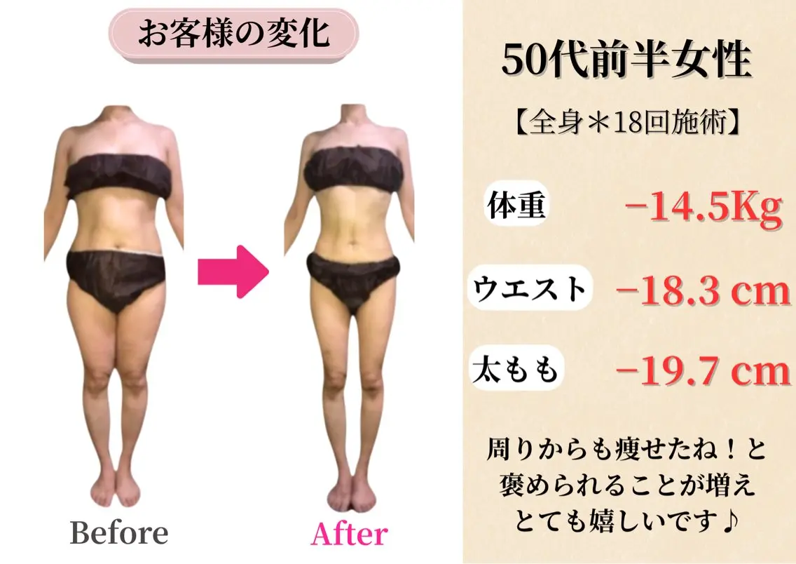 エステ 本格痩身＊透明美肌 BelleWhiteのエステ・リラクイメージ