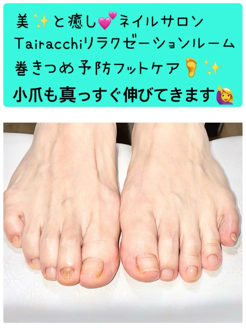 ネイル フットネイル Tairacchi タイラッチのエステ・リラクイメージ