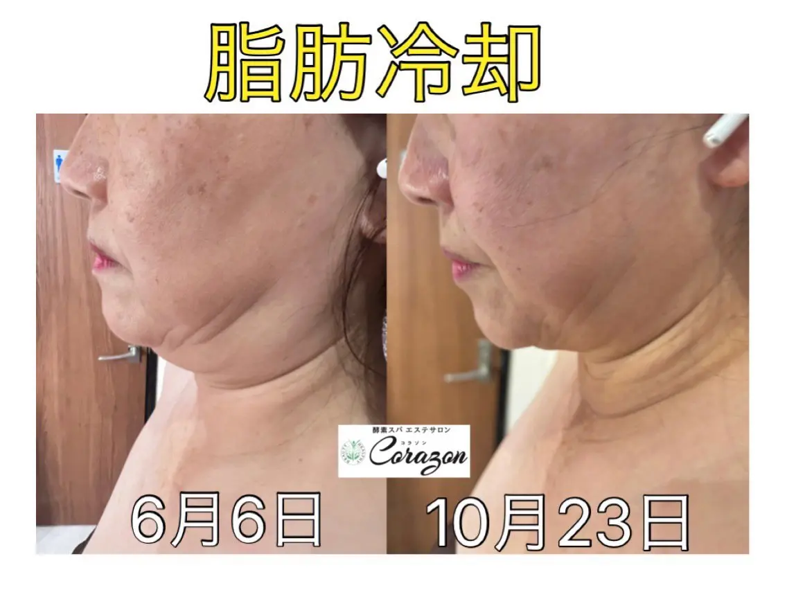 エステ Corazon コラゾンのマツエク・マツパデザイン