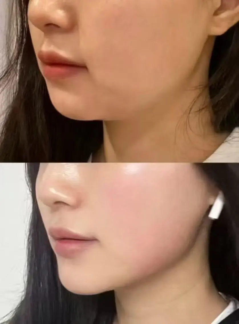ネイル 愛維美水光専門店 川崎彩鳳のエステ・リラクイメージ