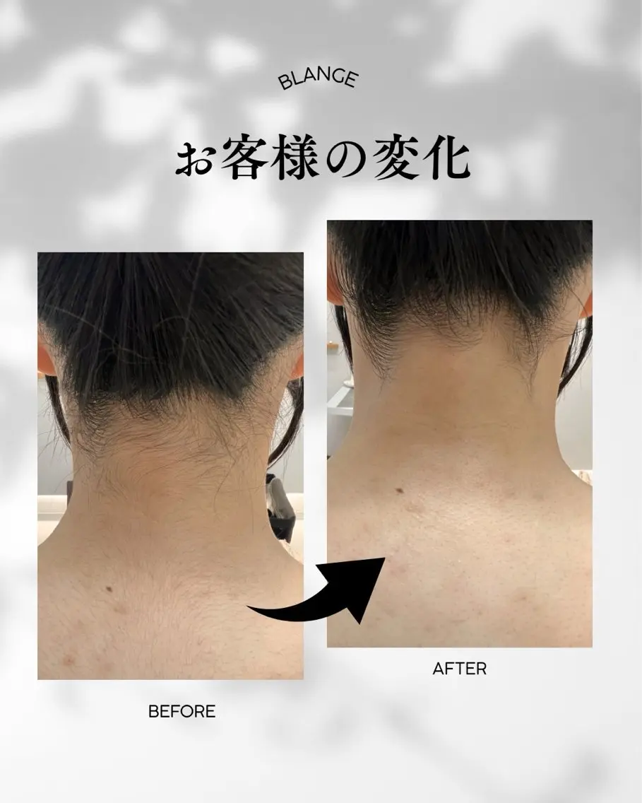 その他 本格シェービング Kimuraのその他イメージ