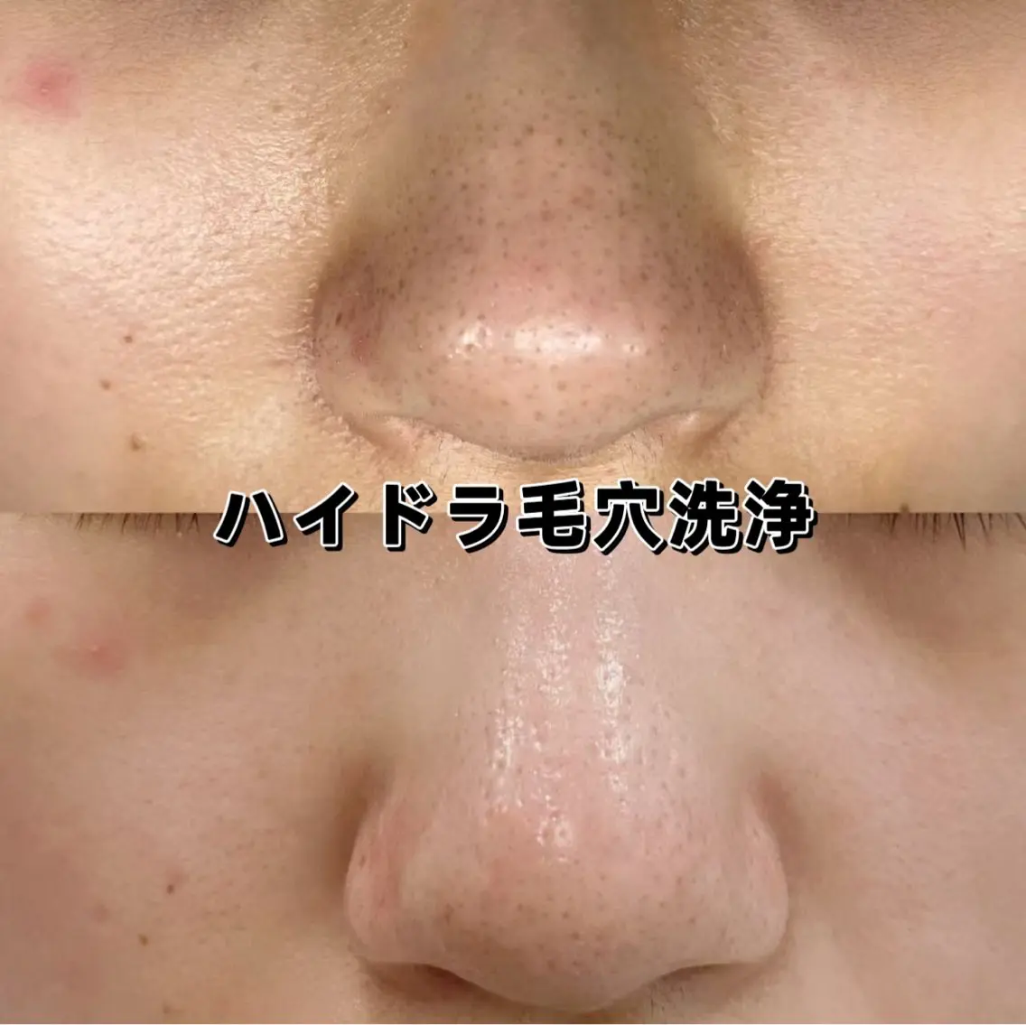 美BELLO 池袋のエステ・リラクイメージ
