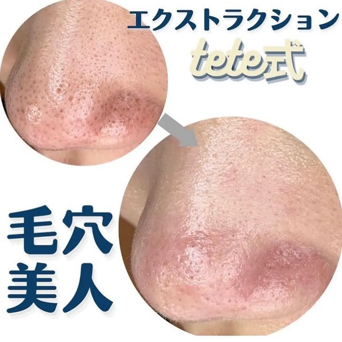 毛穴肌質ケアサロン Yourmeユアミーのエステ・リラクイメージ