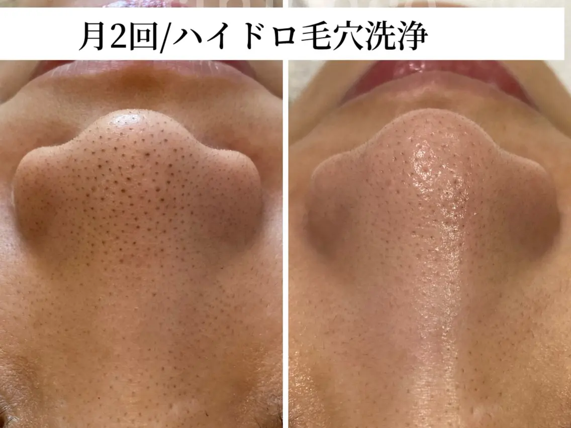 TRINIENCE 南流山店のエステ・リラクイメージ