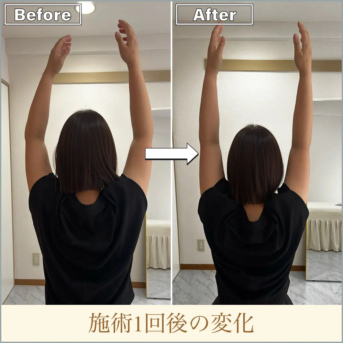 【🍃美容整体60分】首肩集中ボディケア🍃 首や肩まわりを中心にケアする人気メニュー✨PC・スマホ利用が多い方はぜひ◎の写真