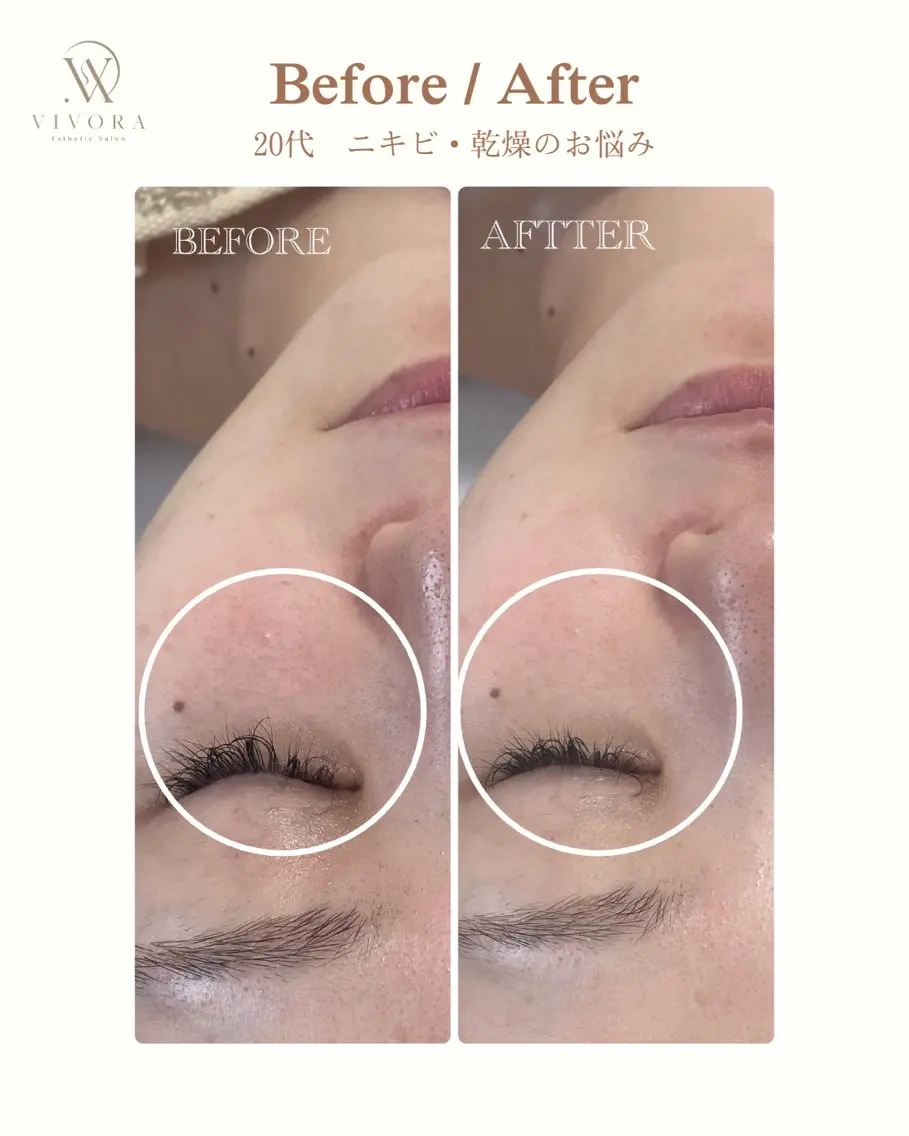 VIVORA ASAMI🌿のエステ・リラクイメージ