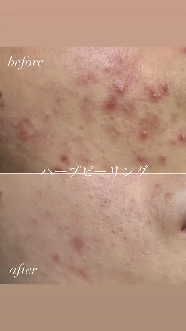 エステ リラク 肌質改善サロン réposのその他イメージ