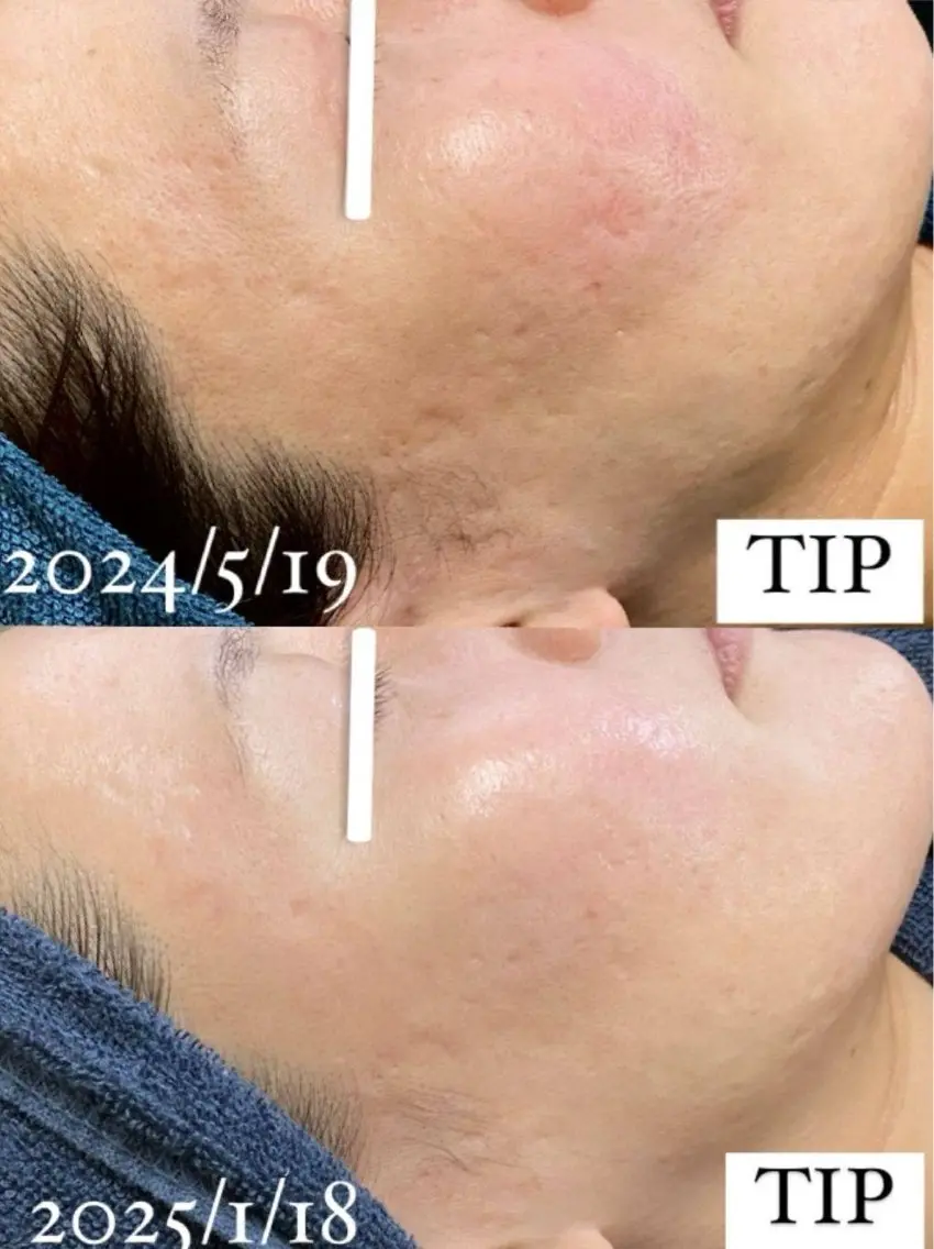 エステ Ellebeauty relaxationのエステ・リラクイメージ