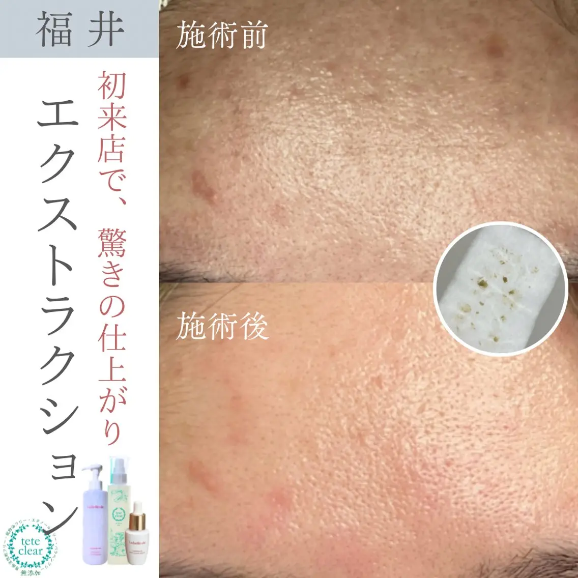 毛穴肌質ケアサロン Yourmeユアミーのエステ・リラクイメージ
