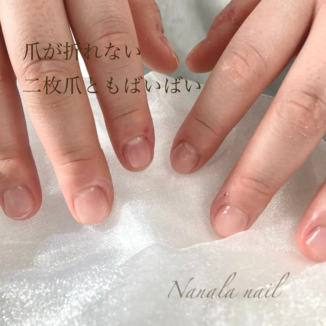 美爪になれるクリアネイル(オフケア込み)の写真