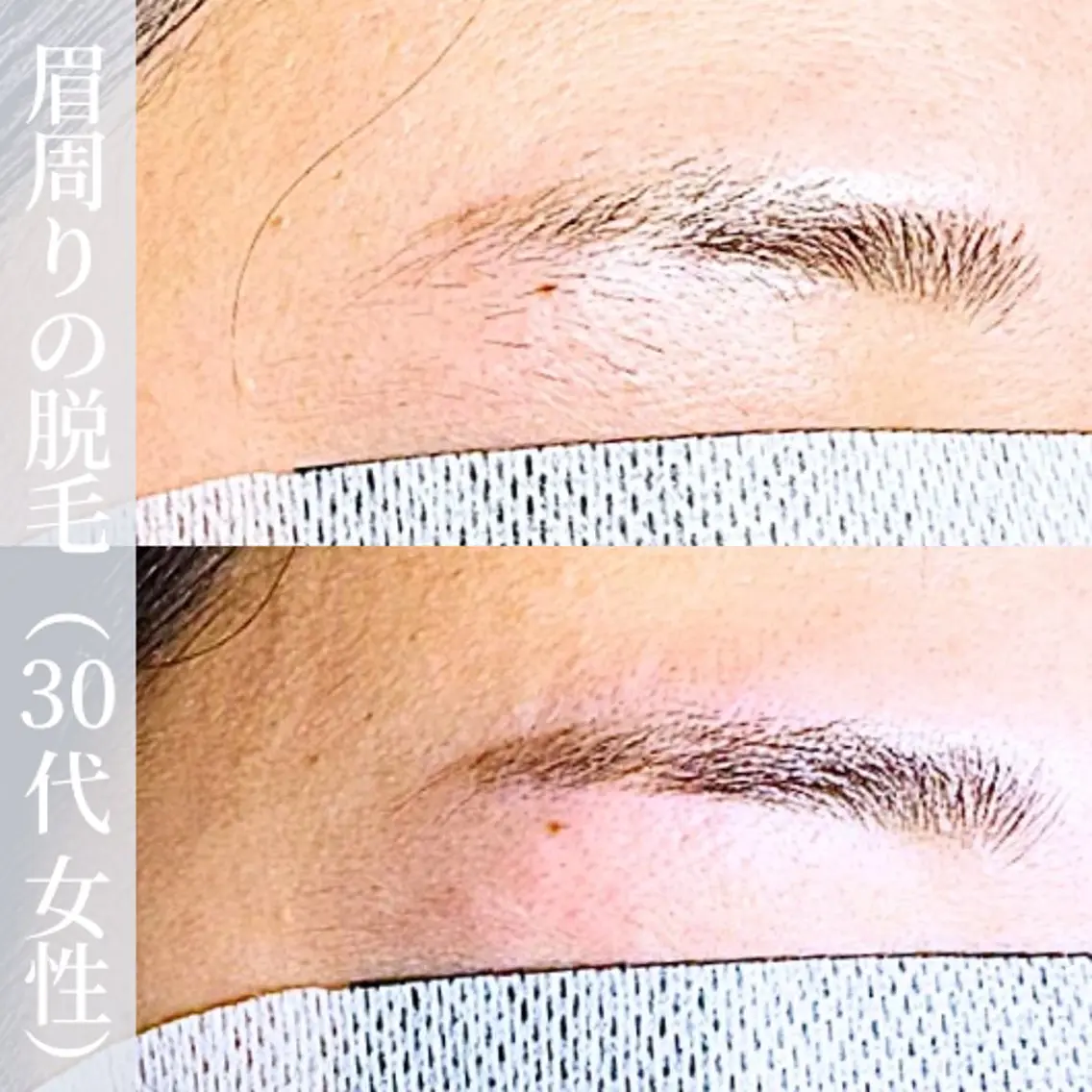 アイブロウ 眉毛ワックス脱毛 【一本ずつ脱毛】 ReMove 柏のエステ・リラクイメージ