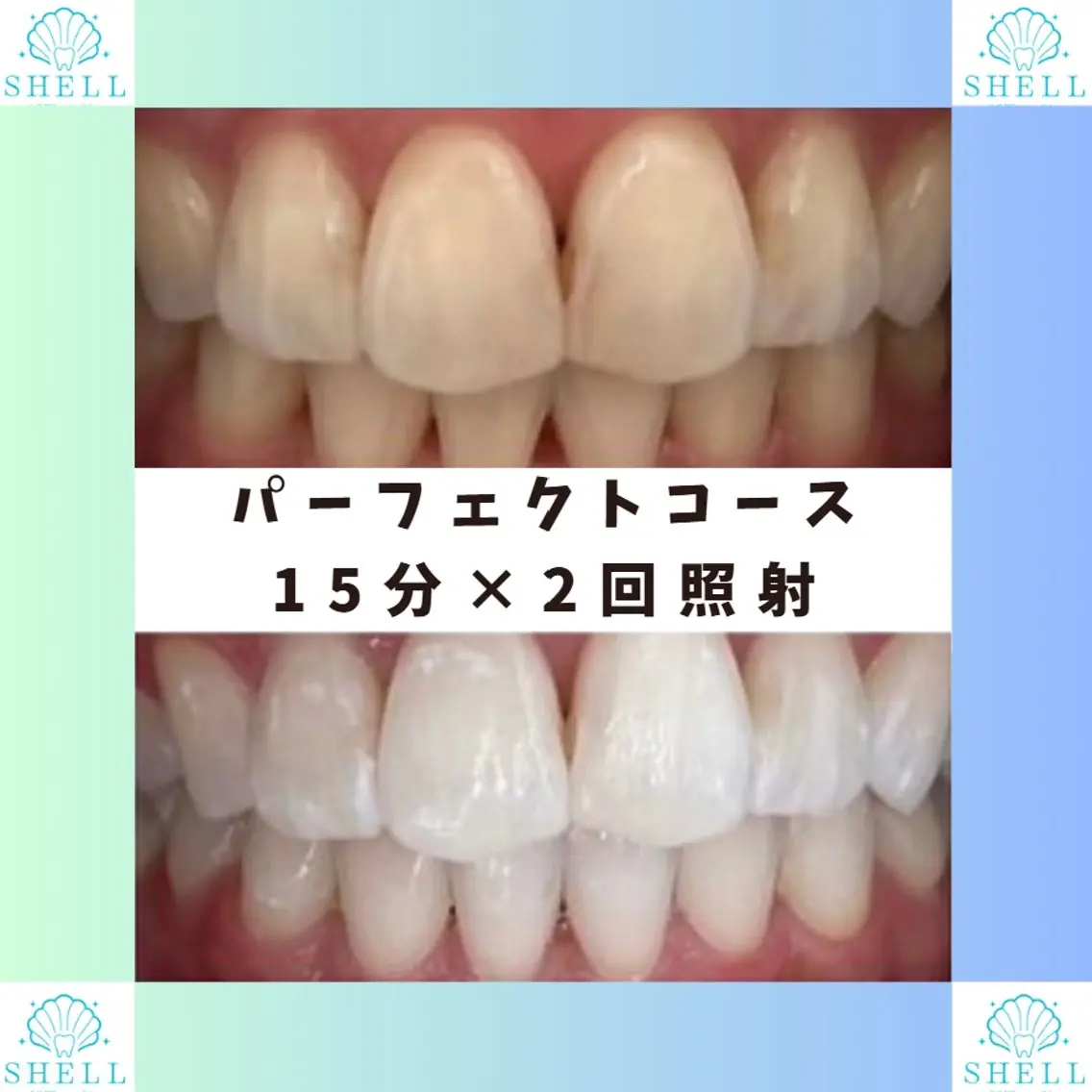 パーマ メンズ キッズ セルフホワイニング サロンSHELL木場のエステ・リラクイメージ