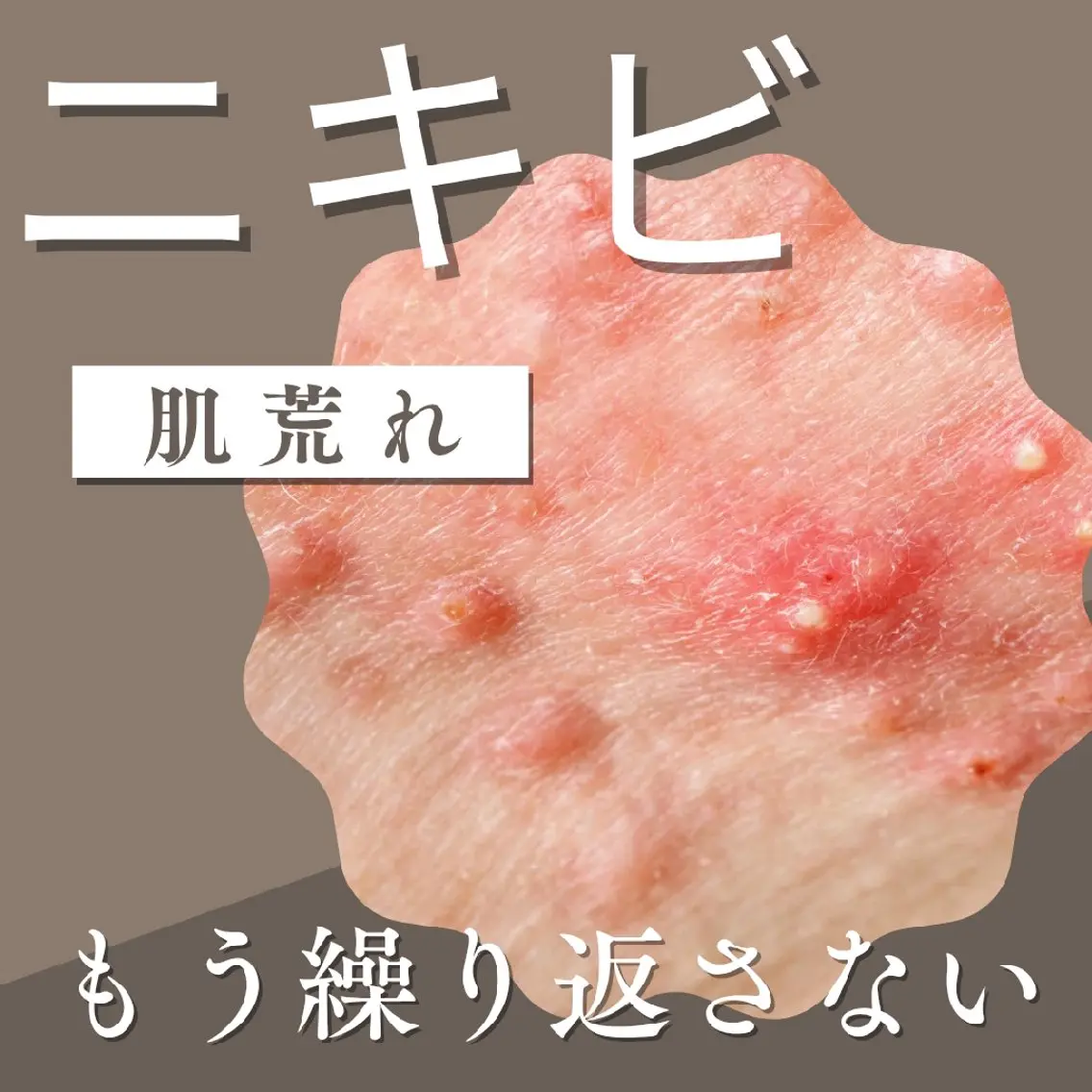 エステサロン NICOLIのエステ・リラクイメージ